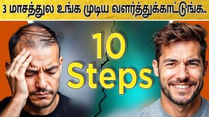 10 steps to Avoid Hair Fall